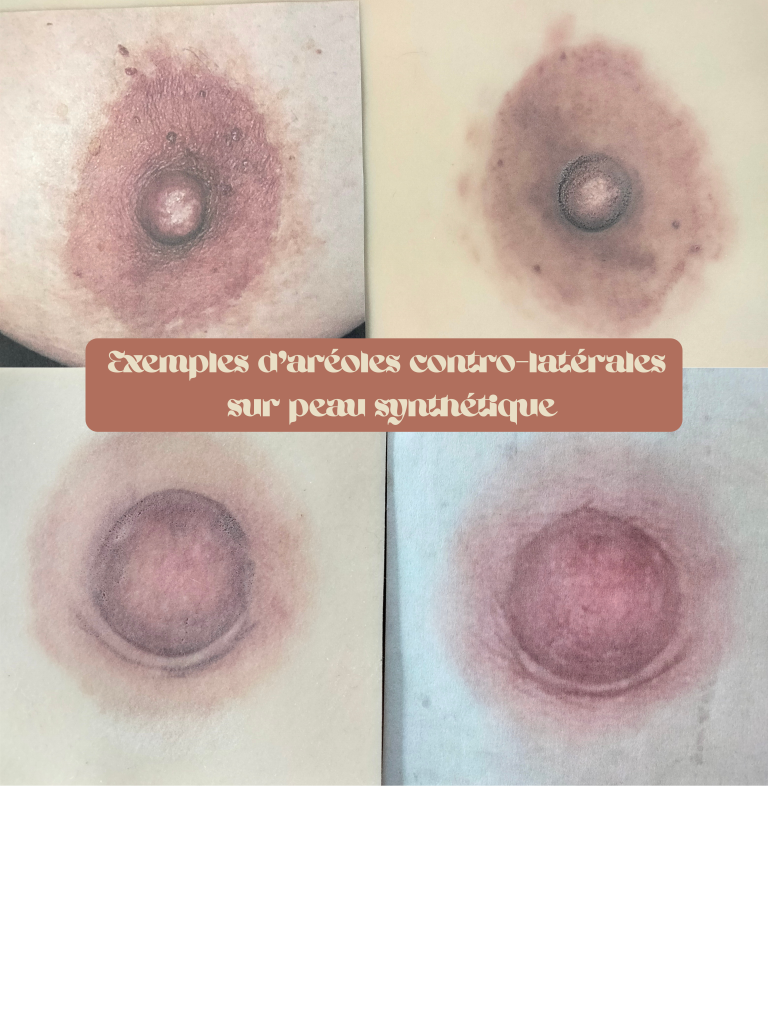 Dermopigmentation réparatrice à Bonneville, Haute-Savoie