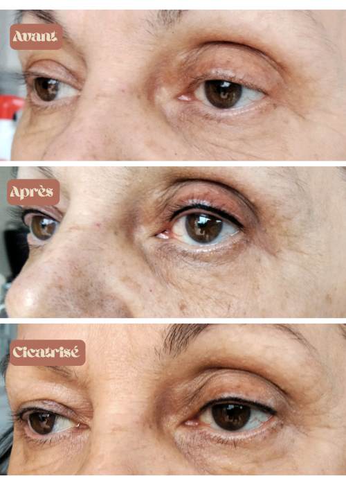 Maquillage permanent résultat tatouage ras de cils vue de 3/4, avant, après et cicatrisé à Bonneville