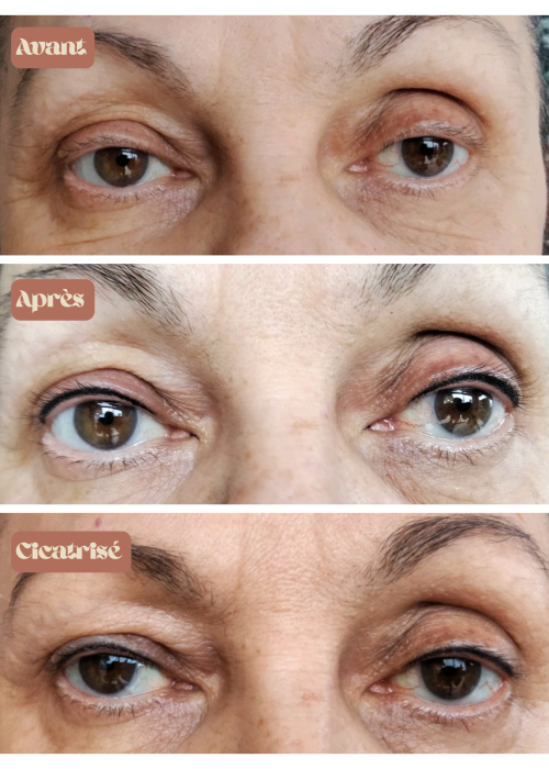 Maquillage permanent ras de cils vue de face avant, après et après cicatrisation de six semaines